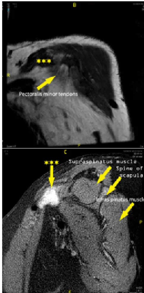 Figure 1. Photograph shows a significant 