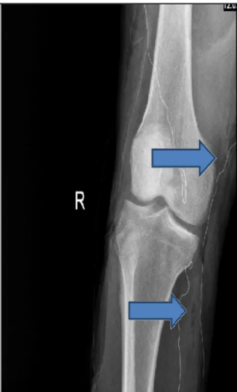 Şekil 1. Hastanın preoperatif görünümü. 