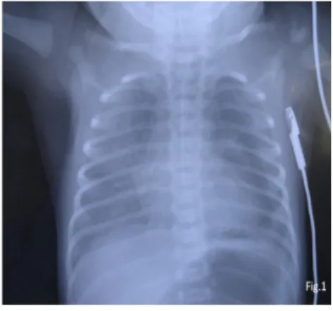 Figure 3: Significant subcutaneous 