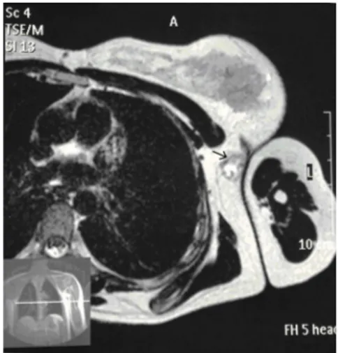 Figure 1. Axial T2-weighted image