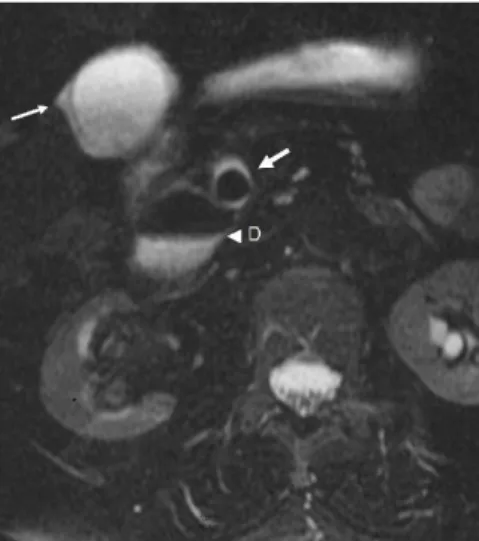 Figure 2. Axial T2-weighted FSE image 