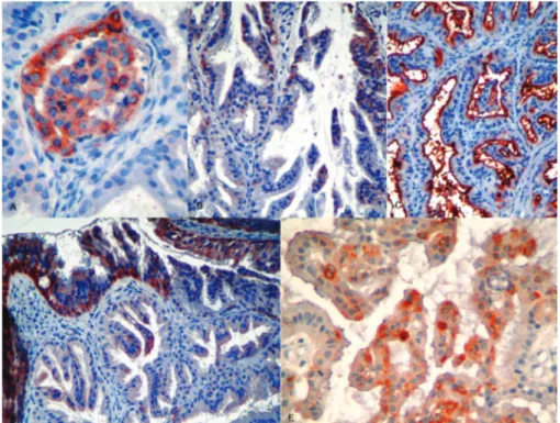 Table 1: The features of the antibodies and the results of immunohistochemical staining.
