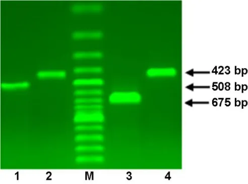 Figure 2. Representative gel image of 4977 bp and 7436 bp mtDNA deletions.  M=100 bp ladder; 