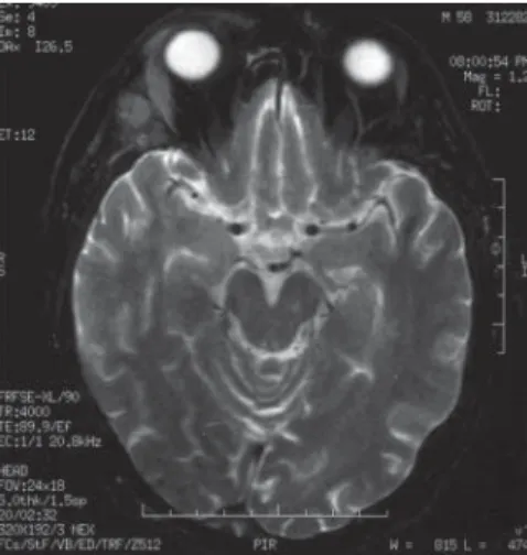 Figure 1. Cranial magnetic resonance 