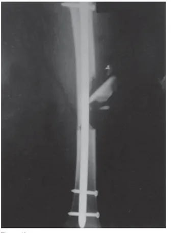 Figure 1. These radiographs were taken in a 21-year-old female with left-sided 