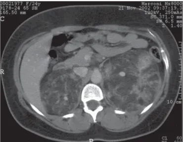 Figure 2. The postoperative CT after contrast dye administration of the 