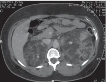 Figure 2. The postoperative CT after contrast dye administration of the 