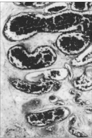 Figure 3. High power view of polyp covered by 