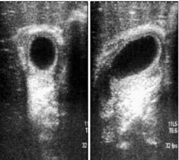 Figure 1 a,b. Axial (a) and sagittal (b) images of abdominal ultrasonography 