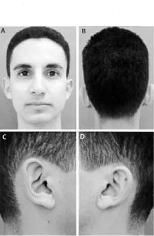 Figure 3. Standard  views for otoplasty