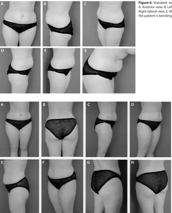 Figure 7. Standard  views for contour 