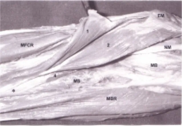 Şekil  1:  Sol  ön  kolun  proximalde  lateralden görünüşü. MFCR,  m.  flexor  carpi  radialis;  NM,  n