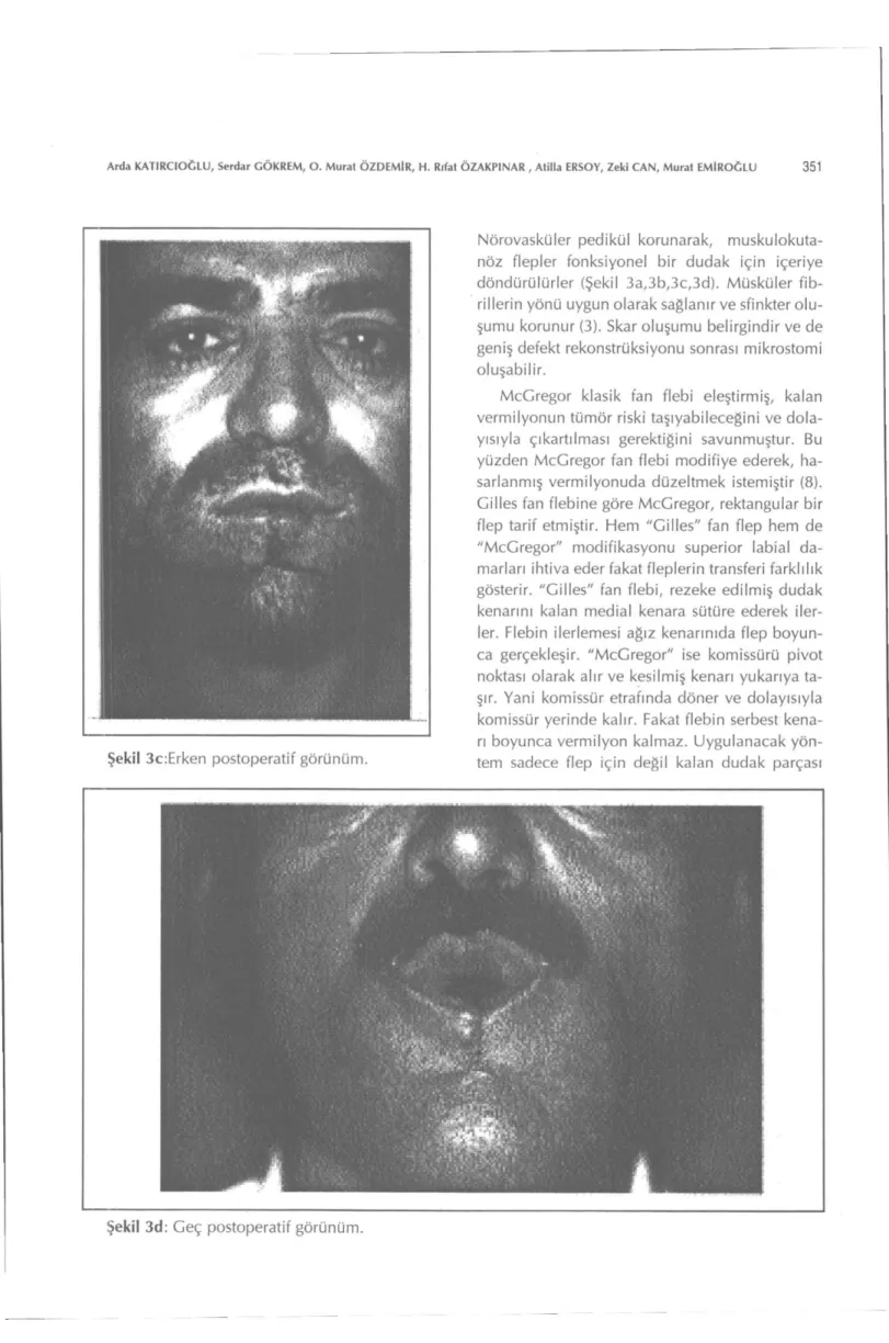 Şekil 3c:Erken postoperatif görünüm. 
