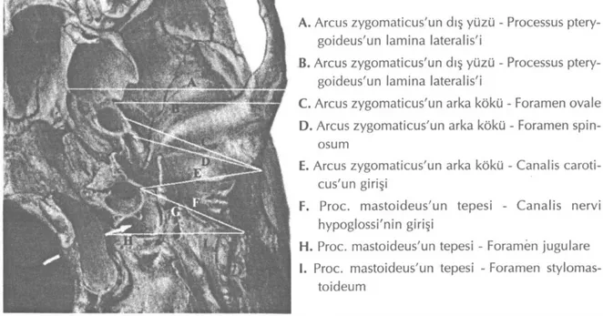 Şekil 1. Fossa infratemporalis'te cerrahi açıdan önemli noktalar için ölçülen uzaklıklar (Sobotta İnsan 