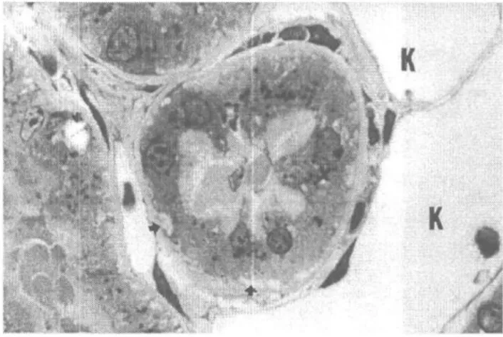 Şekil 4. 6. Haftaya ait mikrografta proksimal tüp hücrelerinde  fırçamsı kenar kaybı (f) ve yer yer hücre sitoplazma  içeriğinin lümene boşaldığı dikkat çekmektedir (-f-)