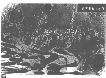 Şekil 6: Dördüncü haftaya ait mikrografta apoptotik spet-