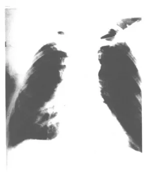 Şekil 1: Olguya ait tiroid sintigrafisi görülmektedir. 