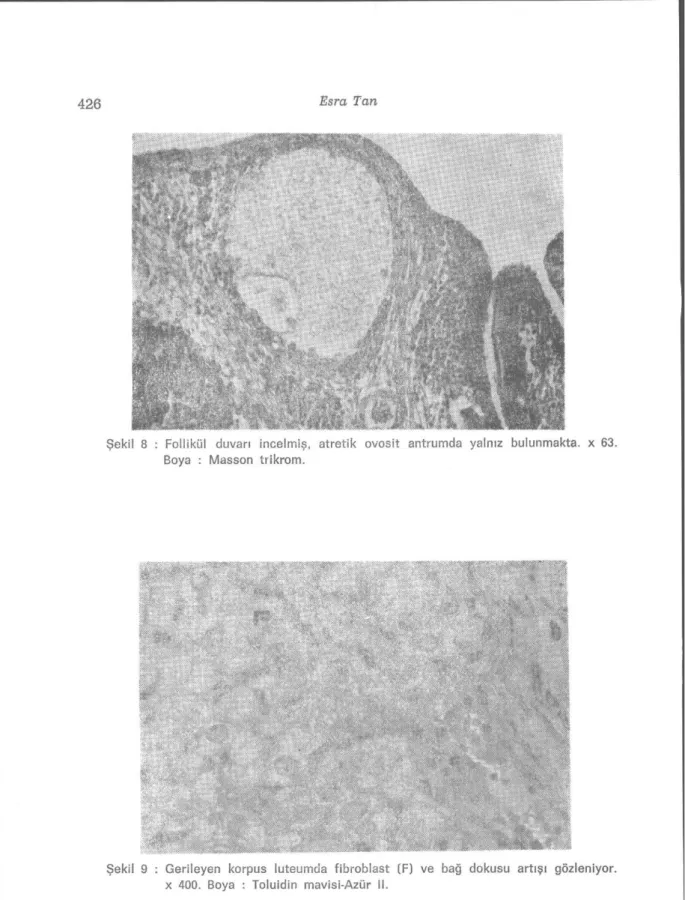 Şekil 9 : Gerileyen korpus luteumda fibroblast (F) ve bağ dokusu artışı gözleniyor.  x 400