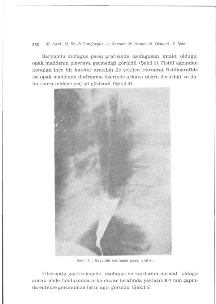 Şekil 3 : Bayumlu ösofagus pasaj grafisi. 