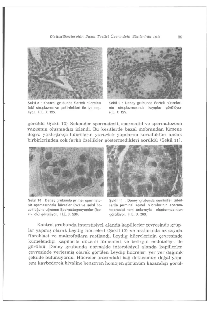 Şekil 8 : Kontrol grubunda Sertoli hücreleri  (ok) sitoplazma ve çekirdekleri ile iyi  seçi-liyor