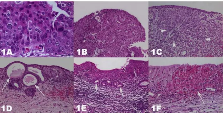 Figure 1A-F. Hematoxylin &amp; Eosin stained urinary bladders. Magnifications are 40, 10, 4, 10, 10, and 20, respectively