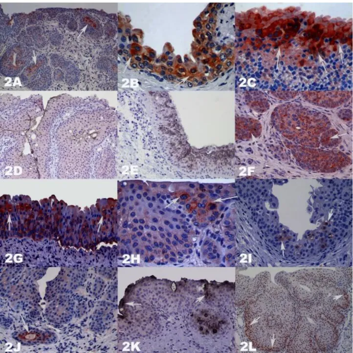 Figure 2A-L. Bladders stained with Streptavidin biotin peroxidase complex method with Mayer’s Hematoxylin counterstain