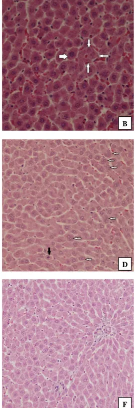 Şekil 1. Deney ratlarının karaciğer dokularındaki histopatolojik değişiklikler. (A) Sadece bakır tedavisi; dejeneratif ve nekrotik hücreler  (oklar) (H&amp;E boyama, Büyütme  x100), (B) Sadece bakır tedavisi; hepatositte karyomegali (kalın ok) ve  karyolit