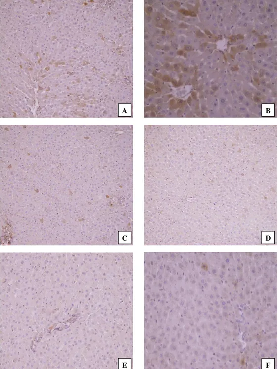 Figure 3. Immunohistochemical findings in the liver tissues of rats. (A) Copper treatment alone; many apoptotic cells showing strong  immunoreaction  for  active  caspase-3  with  predominantly  cytoplasmic  and  some  nuclear  locations  (IHC,  Mayer’s  h