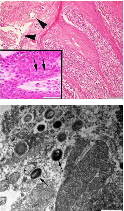 Figure 4. Epithelial hyperplasia, spongiosis, acanthosis,  pustule  formations  (arrow  heads)  and  brightly  eosinophilic intracytoplasmic inclusion bodies (arrows)  (inset)  in  keratinocytes