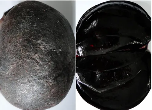 Figure 2. Hairless tumour mass and its cut surface with severe black appearance (case 3)