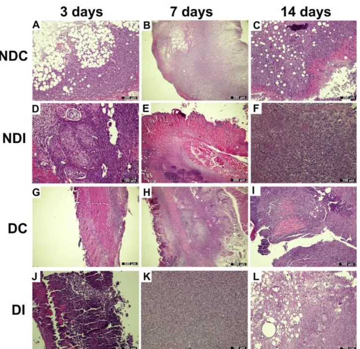 Figure 1. Histopathological changes occurring in wound healing process. A. Fat necrosis at 3 rd  days in Non-Diabetic Control (NDC), 