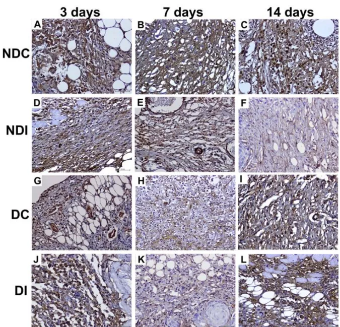 Figure 4. Cells with α-SMA immunoreactivity in the wound site. (Non-Diabetic Control (NDC); Non-Diabetic Insulin (NDI); Diabetic  Control (DC); Diabetic Insulin (DI), White Arrow: α-SMA (+) cells, Dye: IGF-I primary antibody, Bars=50 μm)