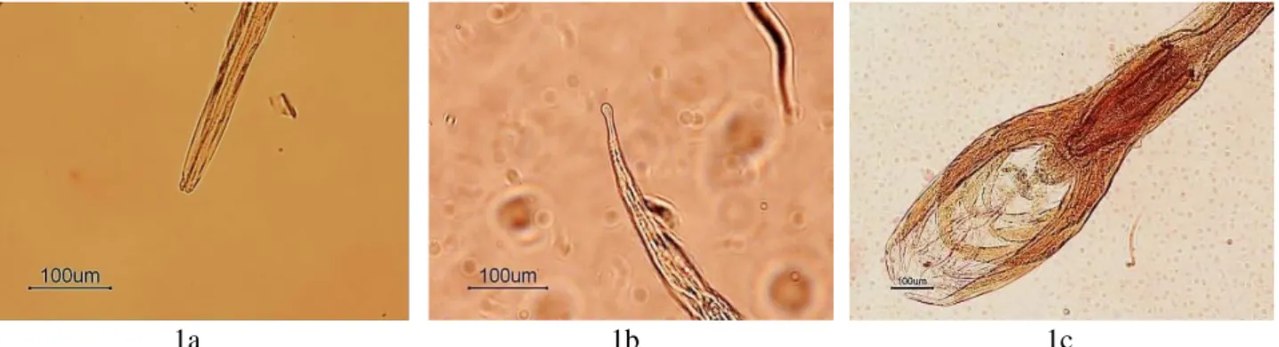 Figure 1. Marshallagia marshalli a) the stoma b) the tail of female c) caudal end of male