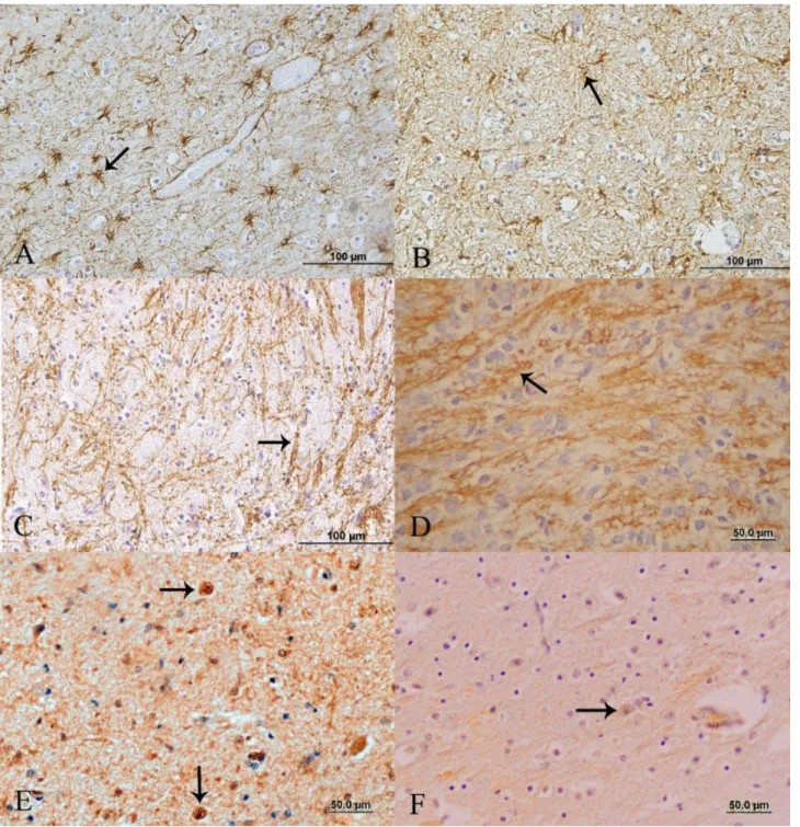 Figure  2.  A)  Sheep,  case  no.  L2.  Intense  GFAP  staining  of  the  pons  showing  numerous  stellate  cells  (arrow)