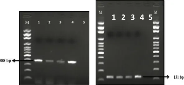 Figure 1.  Electrophorese image of hlyA (388 bp) and iap (131 bp) gene L. monocytogenes isolates by PCR