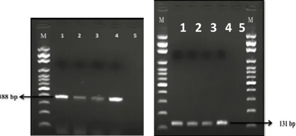 Figure 1.  Electrophorese image of hlyA (388 bp) and iap (131 bp) gene L. monocytogenes isolates by PCR