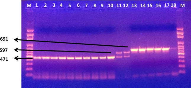 Şekil 2. Pozitif ve negatif kontrollerin elektroforez görüntüsü. M: 100 bp DNA marker, sütun 1: L