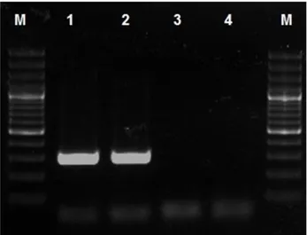Figure 7:  Specific product of BPV-1 use 1F-1R (301 bp) primer  pair.  M:  DNA  ladder  100bp  (Fermenthas,  Lithuania),  Line-1:  Positive  BPV-1  sample,  Line-2:  Positive  Control  of  BPV-1,  Line-3: Negative sample, Line-4: Negative control