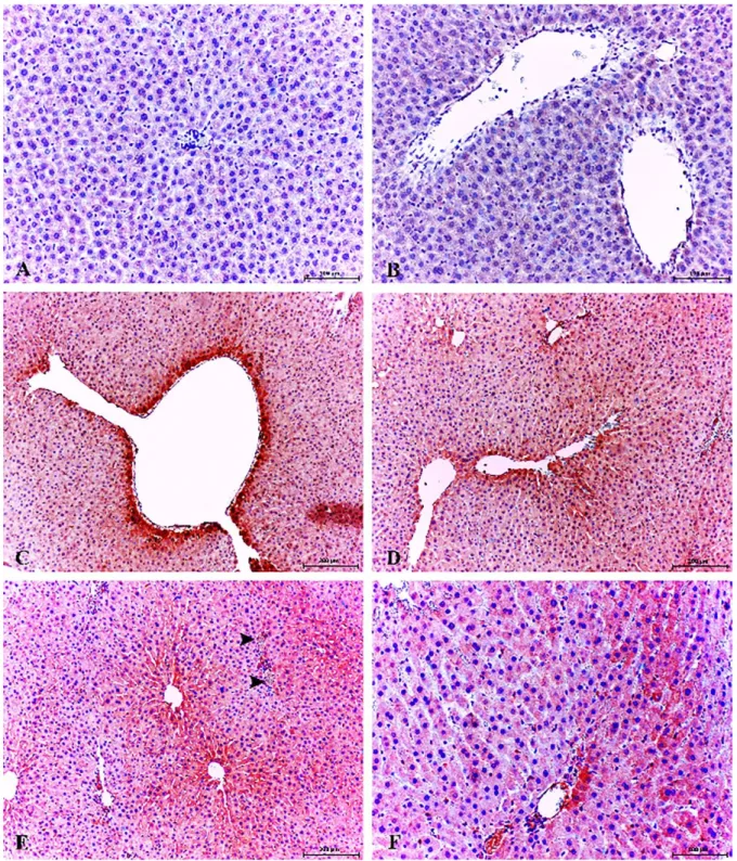 Figure 5. Healthy control group; low expression of 8-OHdG in hepatocytes, Kupffer cells and and pericentral area