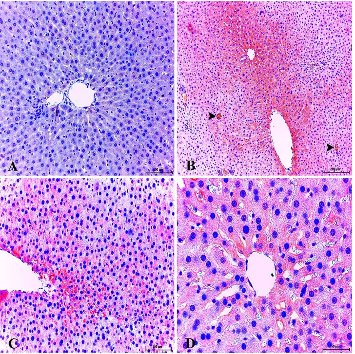 Figure 7. Healthy control group; very slight expression of iNOS liver. ABC technique (anti-iNOS), Mayer's hematoxylin counterstain,  Bar, 100 μm (A)