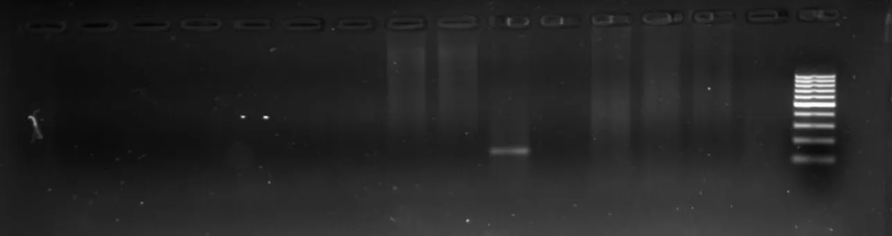 Figure 1. PCR results from positive control samples. Lane 1 (L1) and L9 is 100bp ladder