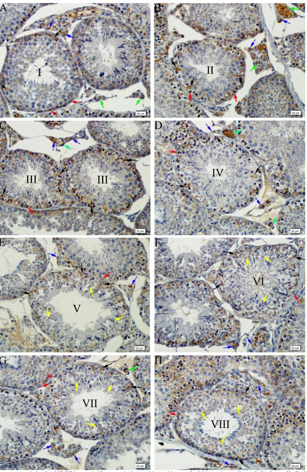 Figure 1. Immunoreactivity for VEGF in seminiferous tubules and intersititum of rabbit testis
