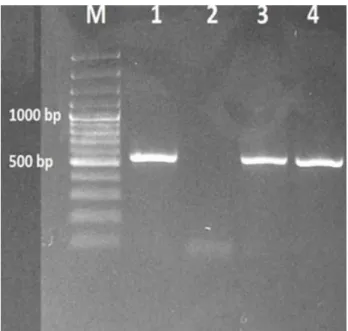 Şekil 1. 16S rRNA geni için spesifik primerlerle (401 bp) yapılan  PZR.  M:  Marker  (100  bp),  1:  Pozitif  kontrol  (E