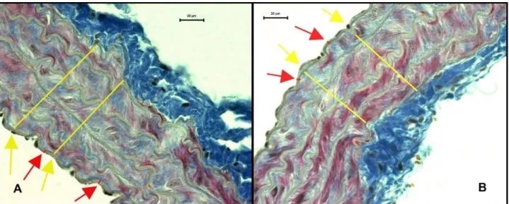 Figure 1. Changes in the thickness of intima and media in thoracic aorta of gonadectomized female mice with and without testosterone  replacement