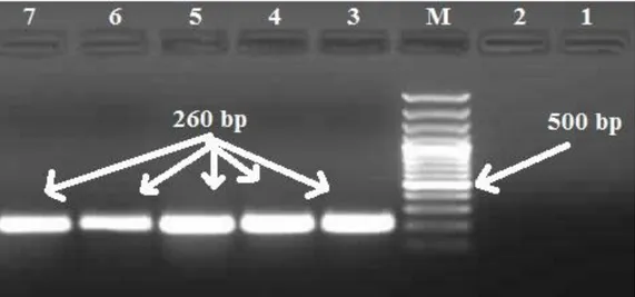 Figure 1. PCR confirmation of  V. furnisii isolates. M: Marker, 100bp. Line 1: Negative control  Vibrio anguillarum  ATCC 19264