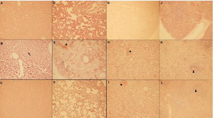 Figure 3. The effect of CDP-choline on CLI induced organ failure. Rats were treated with CDP-choline (100 mg/kg; i.v.) or saline (1  ml/kg; i.v.) 3 hours after the CLI induction