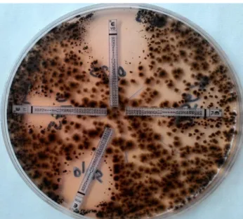 Figure 1. The appearence of slide of A. alternaria from a colony  grown  on  SDA  plate  and  stained  with  lactophenol  blue  under  light microscopy (x40): Conidia specific to A