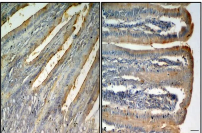 Figure 1. Transverse sections of duodenum from control (A) and  CAP treated (B) groups