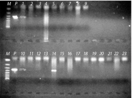 Şekil 1. Sığır doku örneklerine ait DNA’dan N. caninum’un 337 bp’lik Nc5 bölgesini çoğaltan primerler ile elde edilen PCR sonuçları