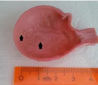 Figure 1. Adult parasites located in mucosa of stomach.  Şekil 1. Mide mukozasına yerleşmiş olgun parazitler